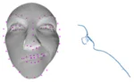 Automatic Objective Severity Grading of Peripheral Facial... — publication preview