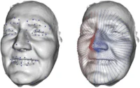 Assessing 3D Volumetric Asymmetry in Facial Palsy Patient... — publication preview