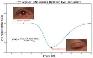 Automated Analysis of Spontaneous Eye Blinking in Patient... — publication preview